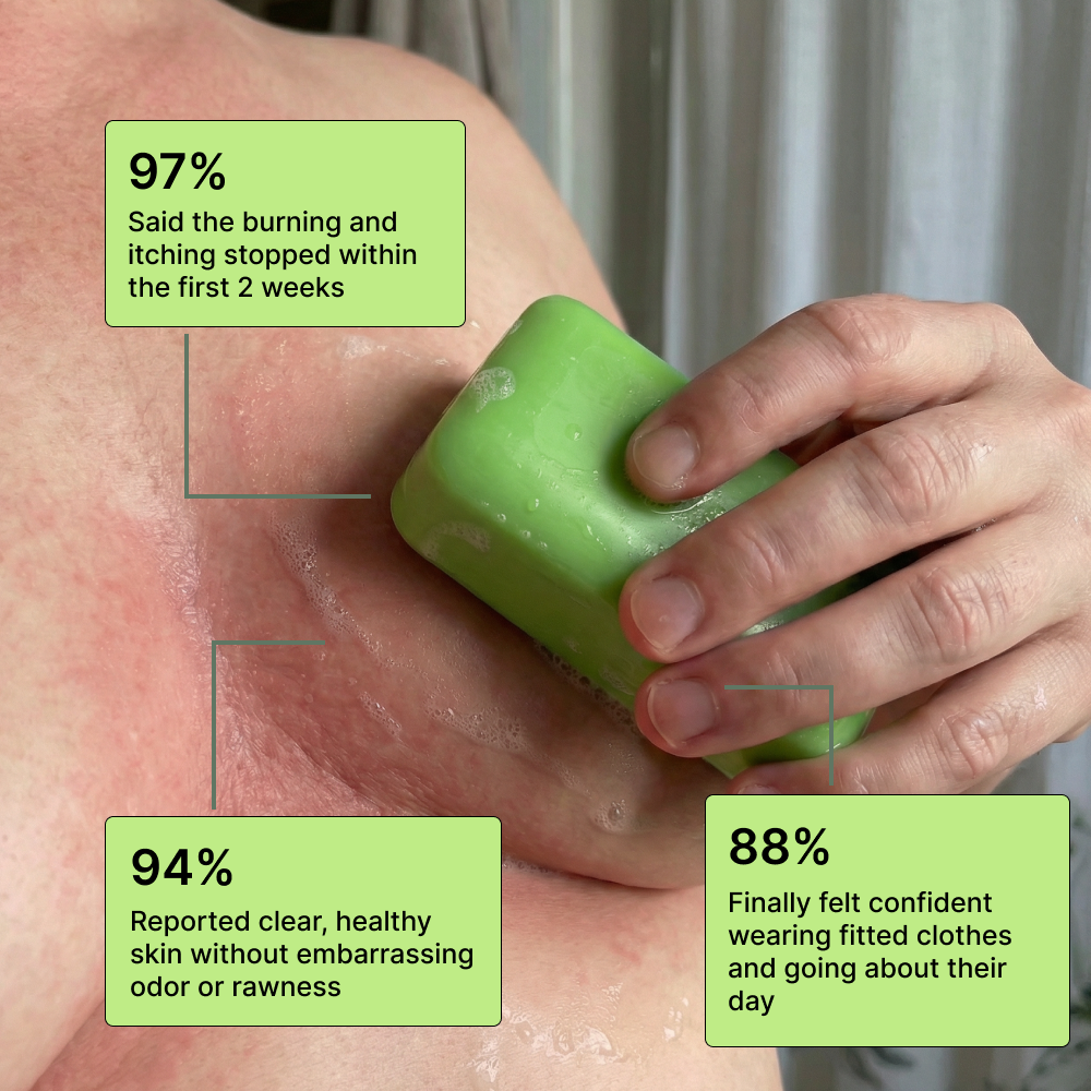 Clinical Antifungal Soap