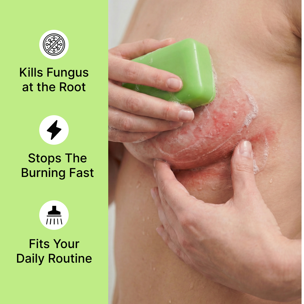 Clinical Antifungal Soap