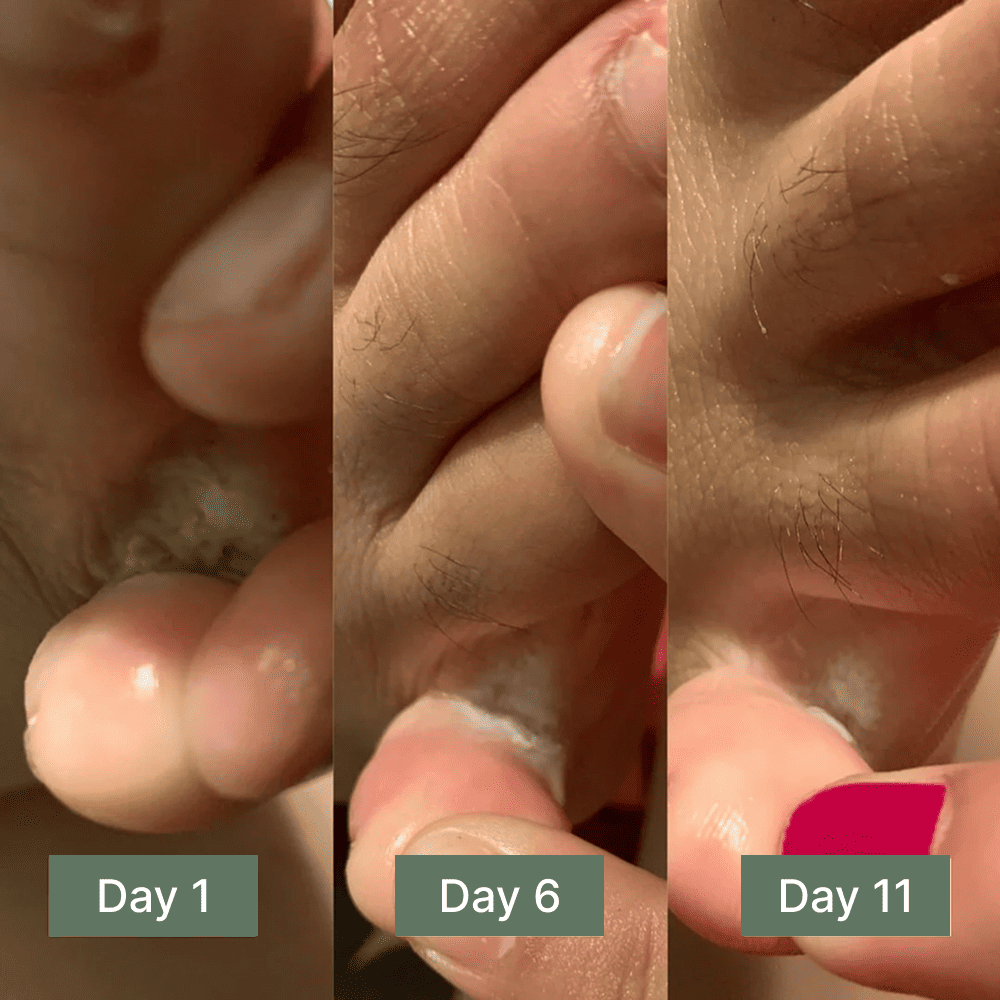 Clinical Antifungal Soap