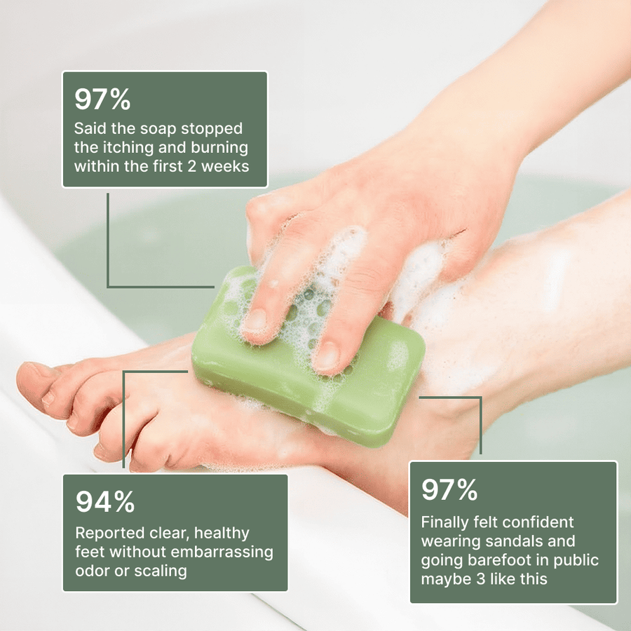Clinical Antifungal Soap